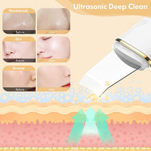 Load image into Gallery viewer, COSMONIC Skin Scrubber, Face Spatula, Blackhead Peeling Remover Facial Pore Deep Cleaner, Gold