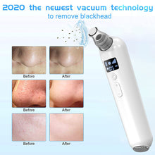 Load image into Gallery viewer, Blackhead Remover Pore Vacuum, 2021 Upgraded Blackhead Remover Vacuum Pore Cleaner Electric Black Head Suctioner Acne Extractor Kit with LED Display, 5 Suction Levels and 5 Probes