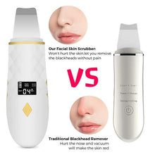 Load image into Gallery viewer, COSMONIC Skin Scrubber, Face Spatula, Blackhead Peeling Remover Facial Pore Deep Cleaner, Gold