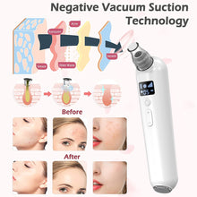 Load image into Gallery viewer, Blackhead Remover Pore Vacuum, 2021 Upgraded Blackhead Remover Vacuum Pore Cleaner Electric Black Head Suctioner Acne Extractor Kit with LED Display, 5 Suction Levels and 5 Probes
