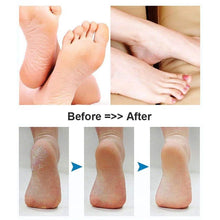 Load image into Gallery viewer, Electric Callus Remover Kit Foot File SWTROOM Rechargeable Portable Waterproof 3 Grinding Heads for Hard Dead Dry Skin
