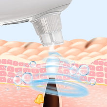 Load image into Gallery viewer, COSMONIC Blackhead Remover Pore Vacuum Pimple Extractor with Curved Acne Removal Kit

